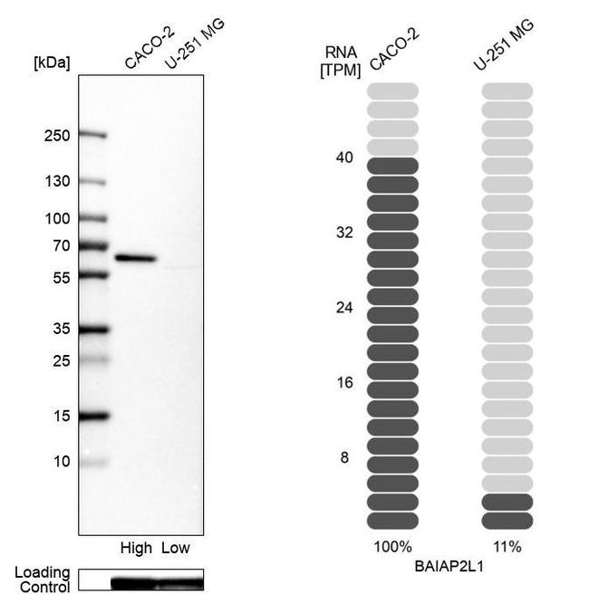 BAIAP2L1 Antibody in Western Blot (WB)