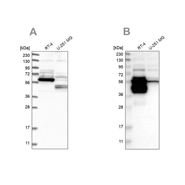 BAIAP2L1 Antibody in Western Blot (WB)