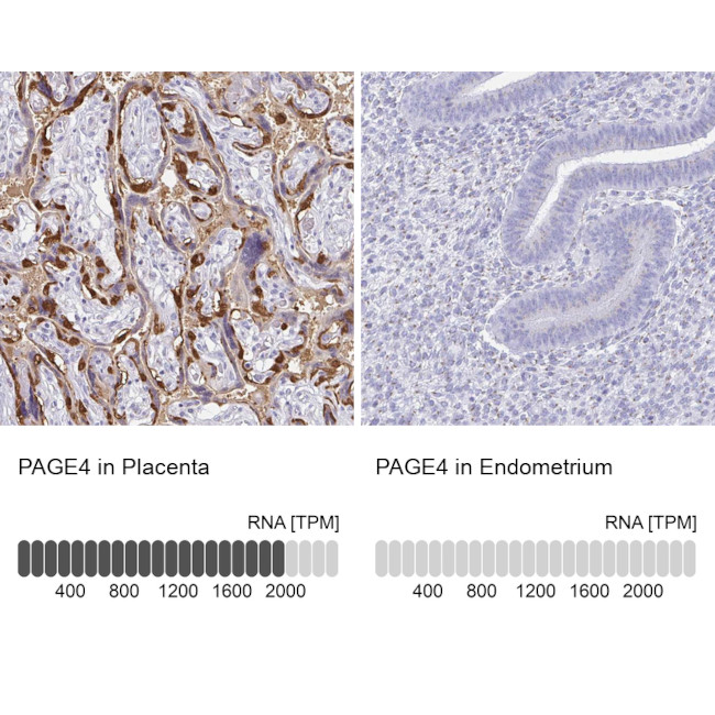 PAGE4 Antibody in Immunohistochemistry (IHC)