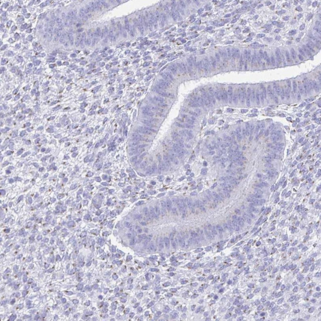 PAGE4 Antibody in Immunohistochemistry (IHC)