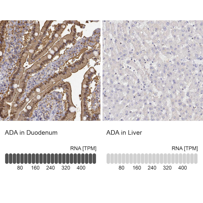 Adenosine Deaminase Antibody in Immunohistochemistry (IHC)