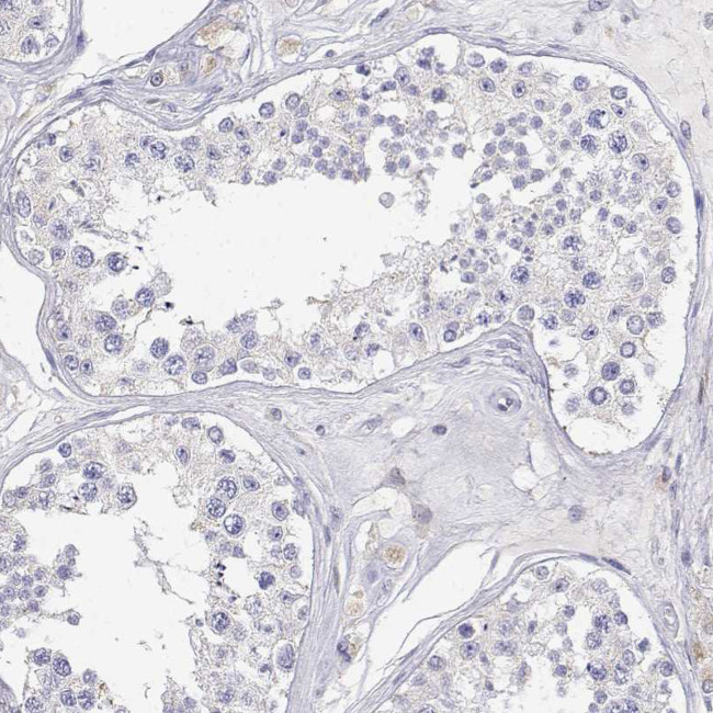 Adenosine Deaminase Antibody in Immunohistochemistry (IHC)