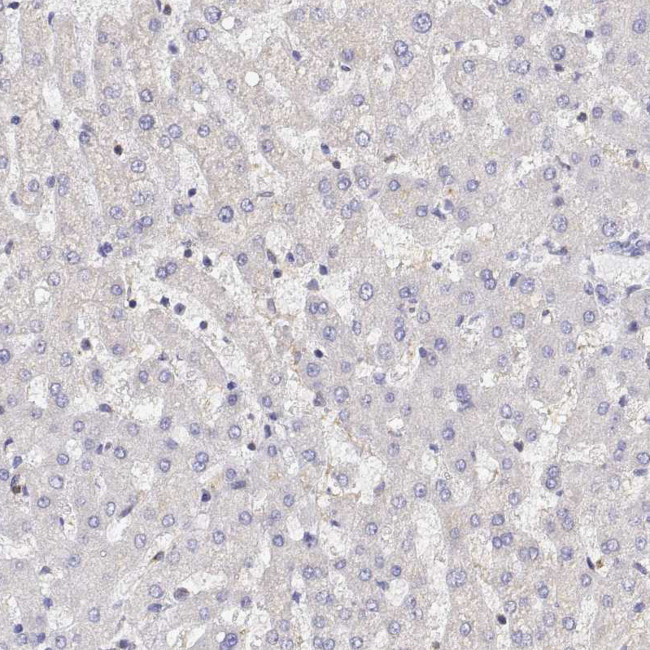 Adenosine Deaminase Antibody in Immunohistochemistry (IHC)