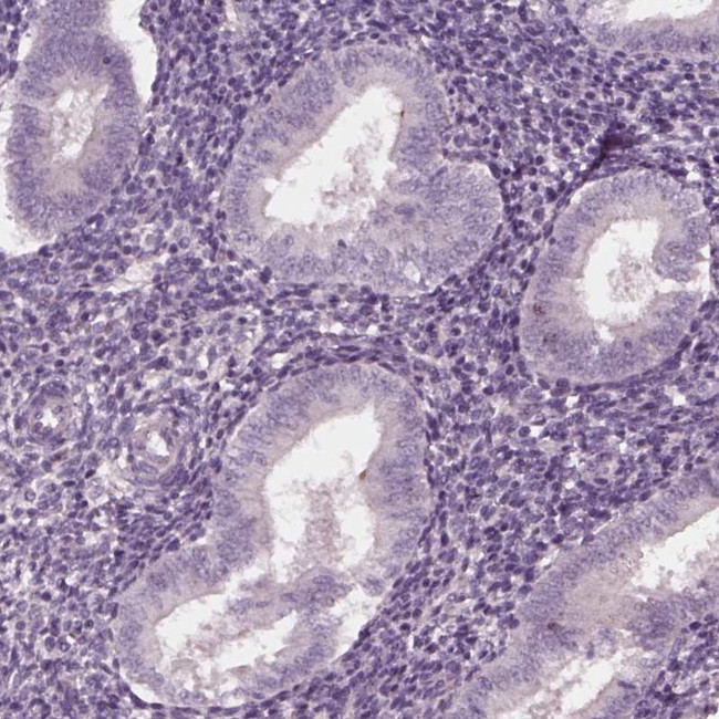 FAM154A Antibody in Immunohistochemistry (IHC)