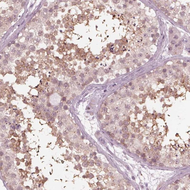 FAM154A Antibody in Immunohistochemistry (IHC)