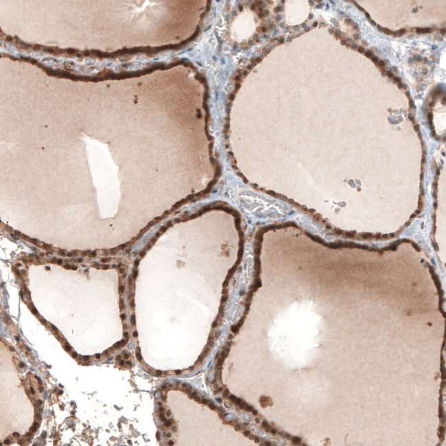 STC1 Antibody in Immunohistochemistry (IHC)