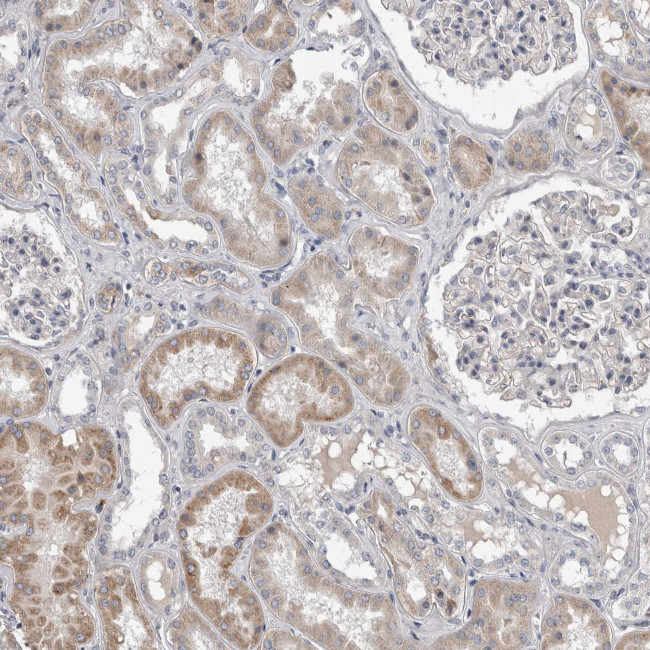 STC1 Antibody in Immunohistochemistry (IHC)