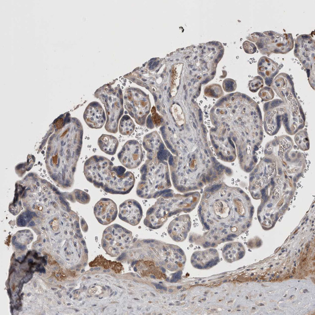 STC1 Antibody in Immunohistochemistry (IHC)