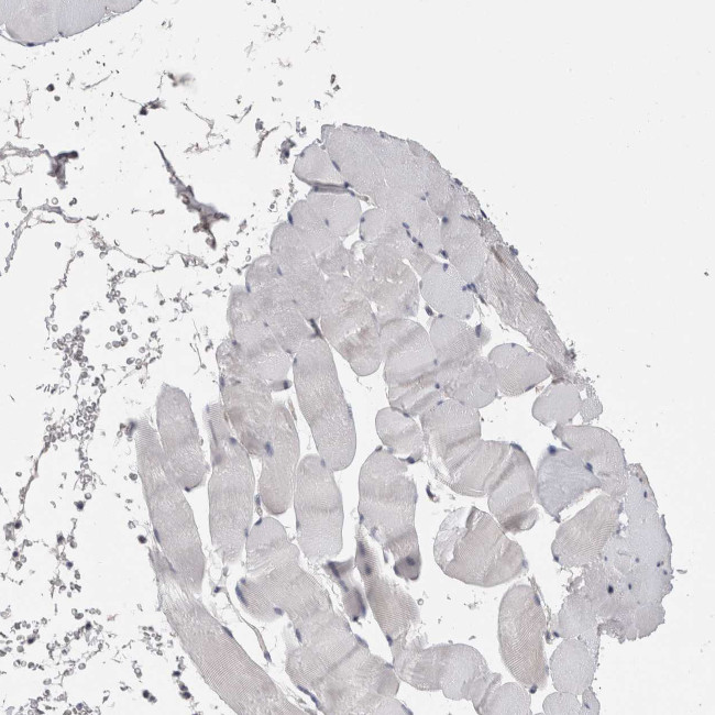 STC1 Antibody in Immunohistochemistry (IHC)