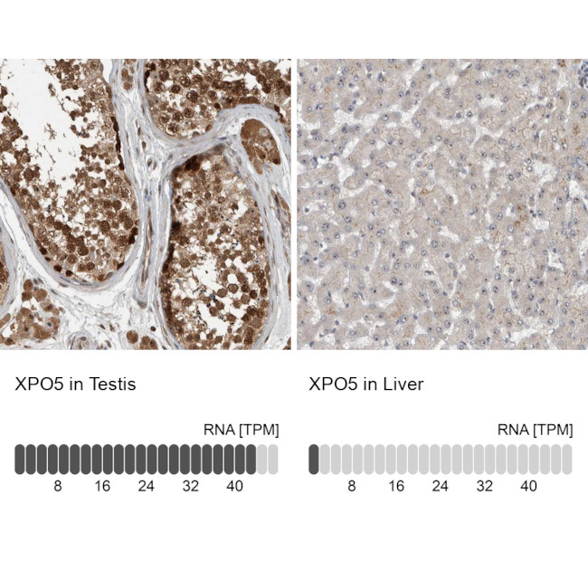 XPO5 Antibody in Immunohistochemistry (IHC)