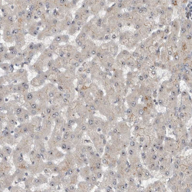 XPO5 Antibody in Immunohistochemistry (IHC)