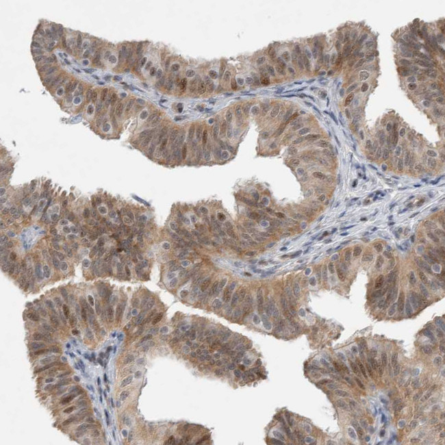 WIPF2 Antibody in Immunohistochemistry (IHC)