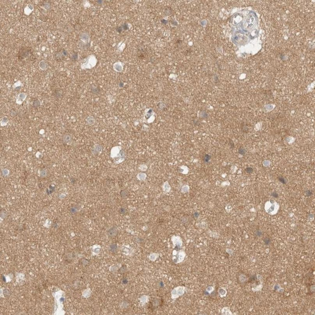 WIPF2 Antibody in Immunohistochemistry (IHC)