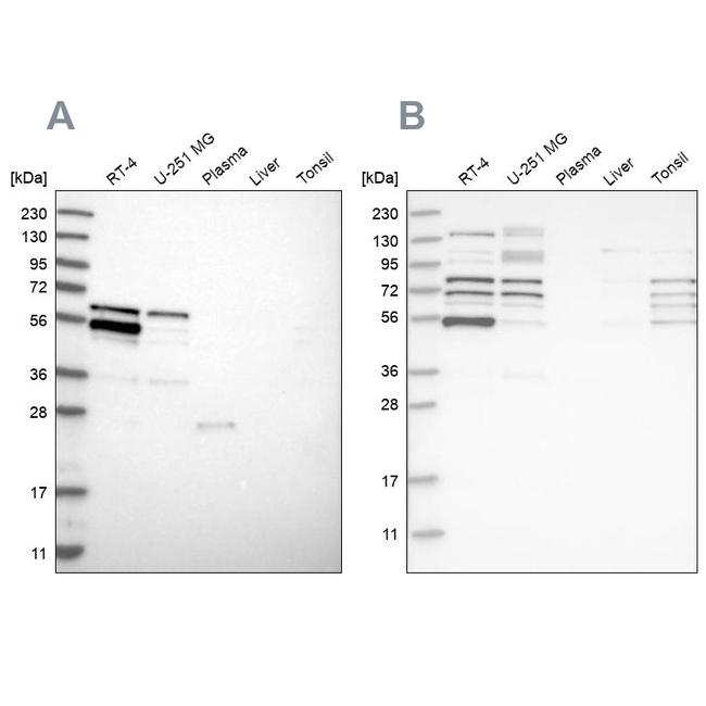 WIPF2 Antibody in Western Blot (WB)