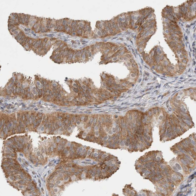 WIPF2 Antibody in Immunohistochemistry (IHC)