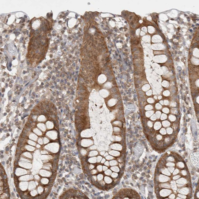 WIPF2 Antibody in Immunohistochemistry (IHC)