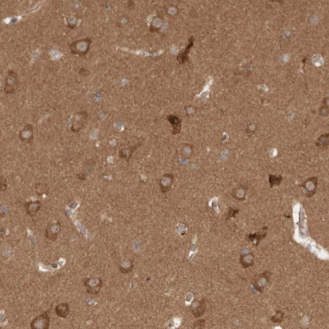 WIPF2 Antibody in Immunohistochemistry (IHC)