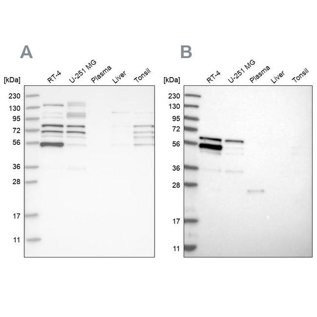 WIPF2 Antibody in Western Blot (WB)