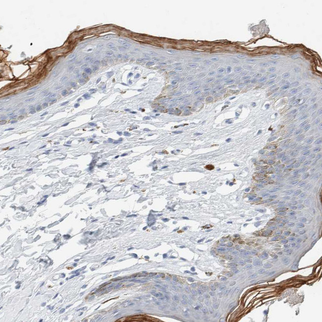 ALOX12B Antibody in Immunohistochemistry (IHC)