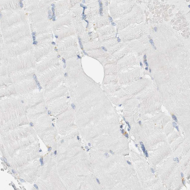 ALOX12B Antibody in Immunohistochemistry (IHC)