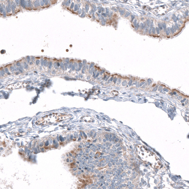 CEP131 Antibody in Immunohistochemistry (IHC)