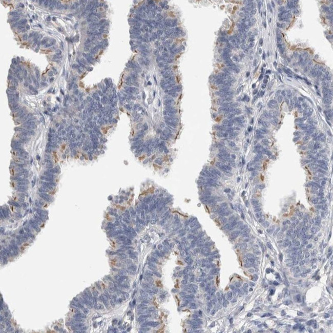 CEP131 Antibody in Immunohistochemistry (IHC)