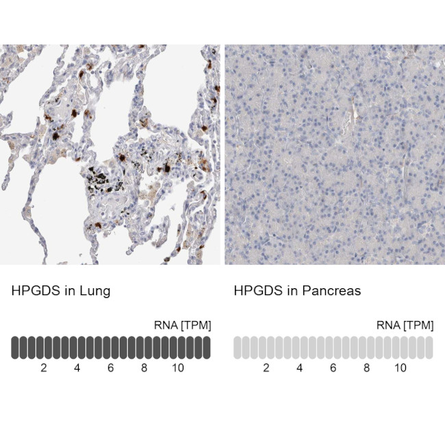 HPGDS Antibody in Immunohistochemistry (IHC)