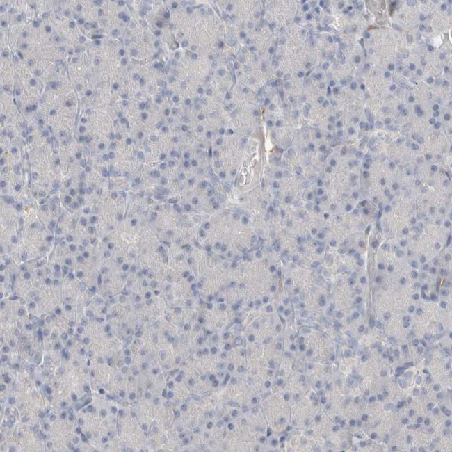 HPGDS Antibody in Immunohistochemistry (IHC)