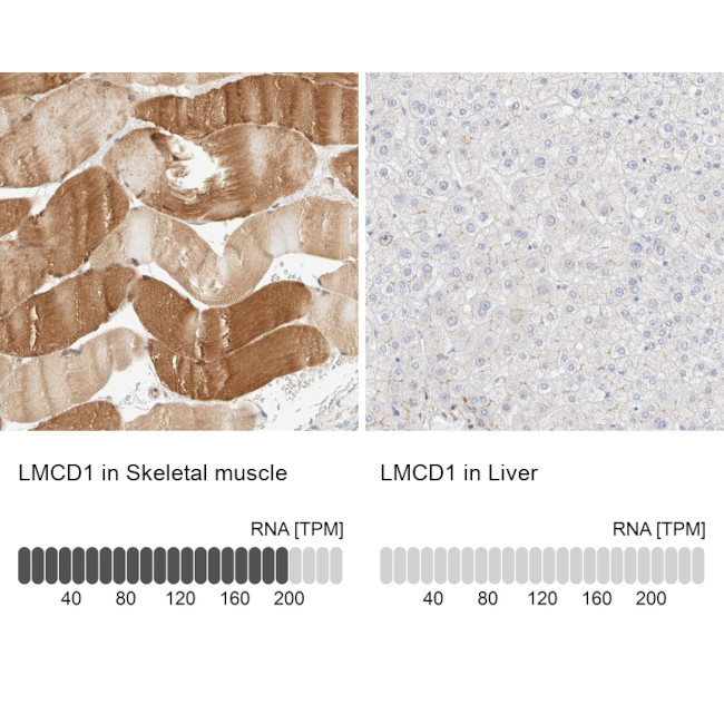 LMCD1 Antibody in Immunohistochemistry (IHC)