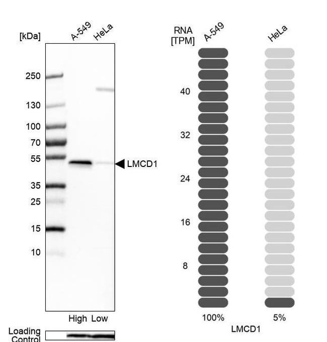 LMCD1 Antibody in Western Blot (WB)