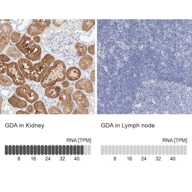 GDA Antibody in Immunohistochemistry (IHC)