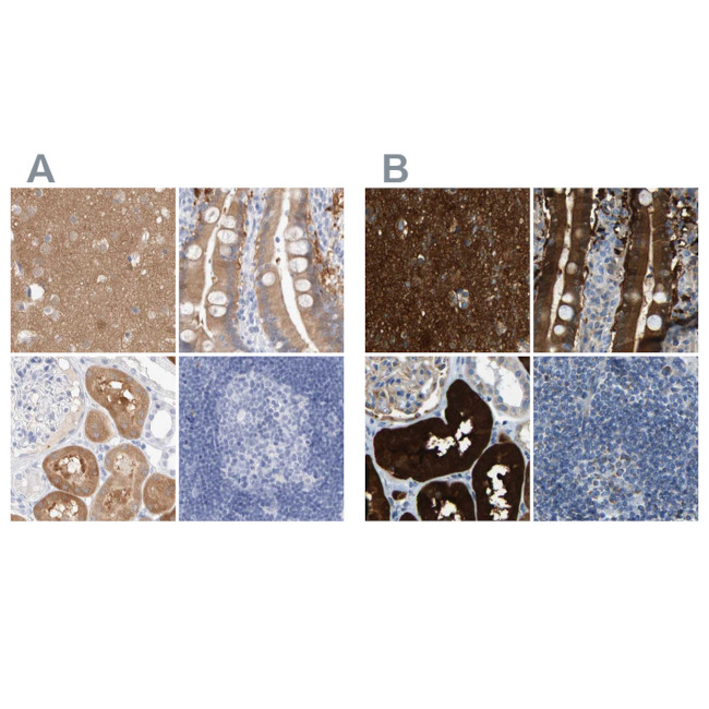 GDA Antibody in Immunohistochemistry (IHC)