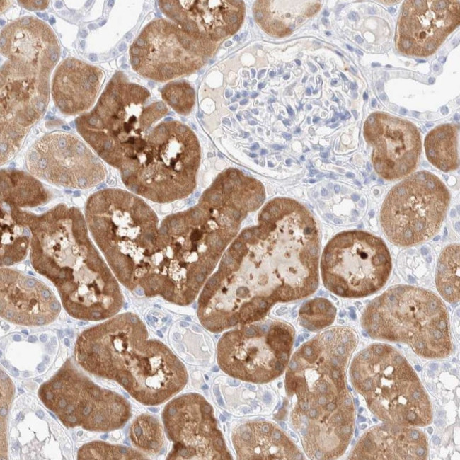 GDA Antibody in Immunohistochemistry (IHC)