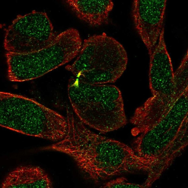 SETX Antibody in Immunocytochemistry (ICC/IF)