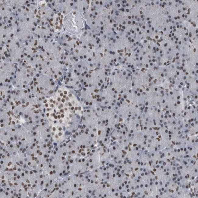 TOP2B Antibody in Immunohistochemistry (IHC)