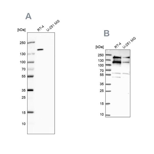 TOP2B Antibody in Western Blot (WB)