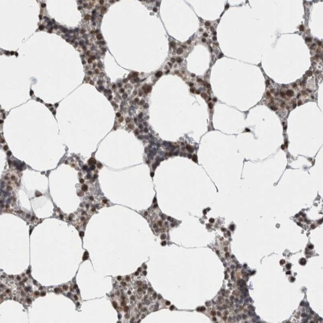 ZBTB11 Antibody in Immunohistochemistry (IHC)