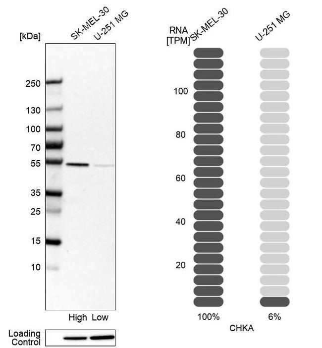 CHKA Antibody in Western Blot (WB)