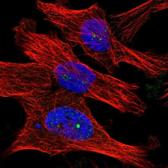 WDR32 Antibody in Immunocytochemistry (ICC/IF)