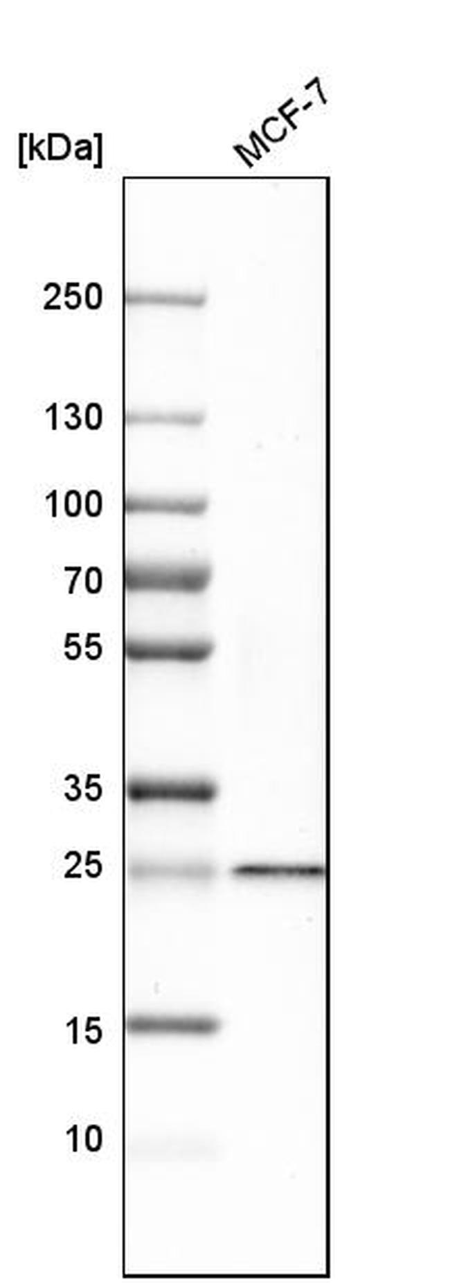 SIKE Antibody in Western Blot (WB)