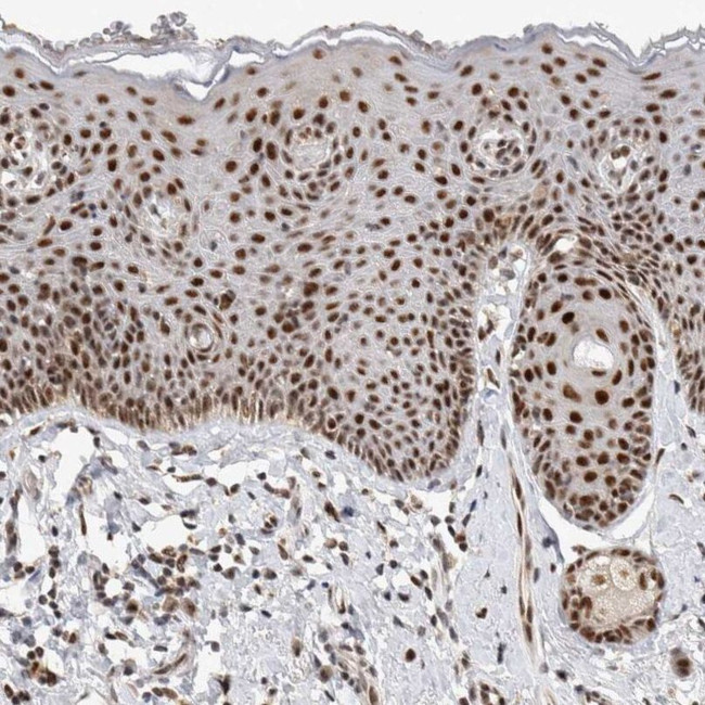 HESX1 Antibody in Immunohistochemistry (IHC)