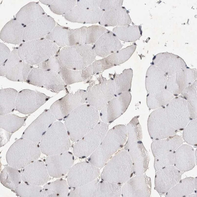 HESX1 Antibody in Immunohistochemistry (IHC)