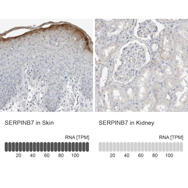 SERPINB7 Antibody in Immunohistochemistry (IHC)