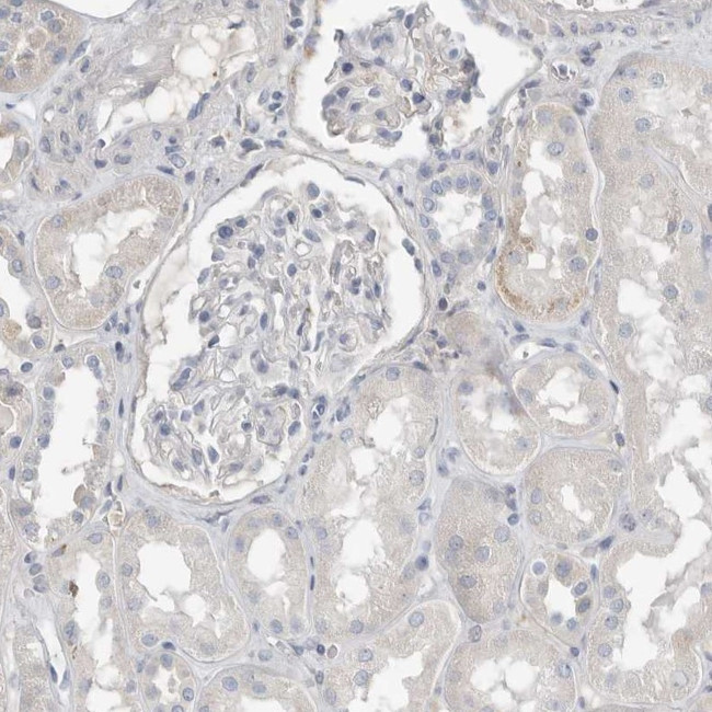 SERPINB7 Antibody in Immunohistochemistry (IHC)