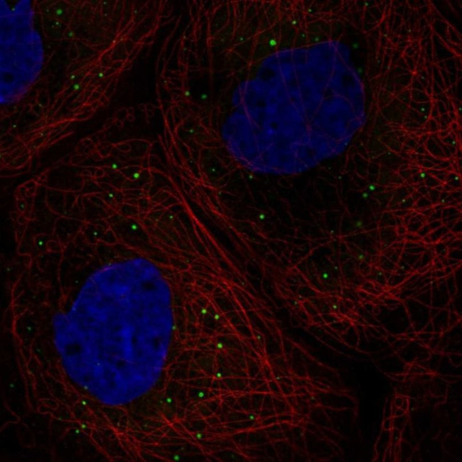 DDX6 Antibody in Immunocytochemistry (ICC/IF)