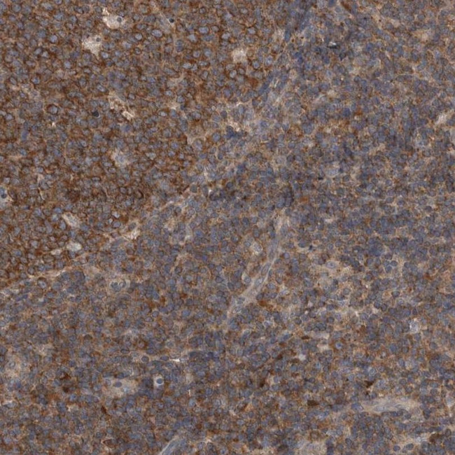 DDX6 Antibody in Immunohistochemistry (IHC)