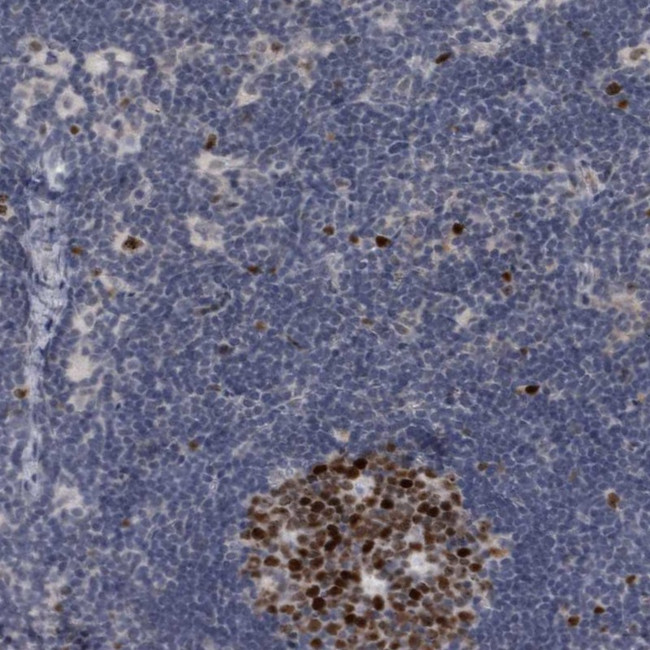 KIF18B Antibody in Immunohistochemistry (IHC)