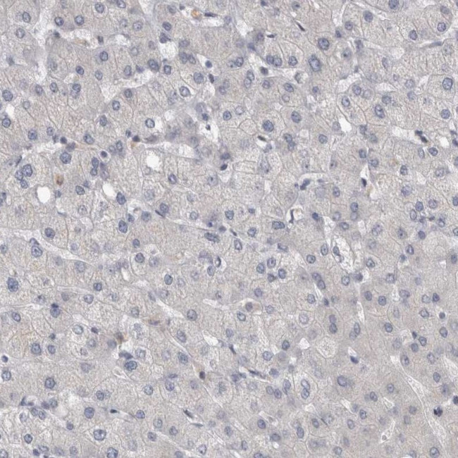 KIF18B Antibody in Immunohistochemistry (IHC)