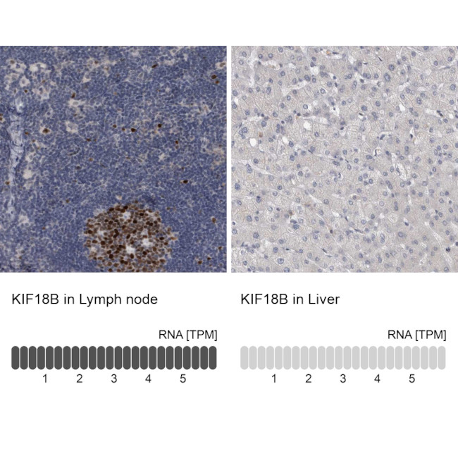 KIF18B Antibody