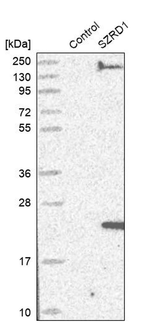 C1orf144 Antibody in Western Blot (WB)